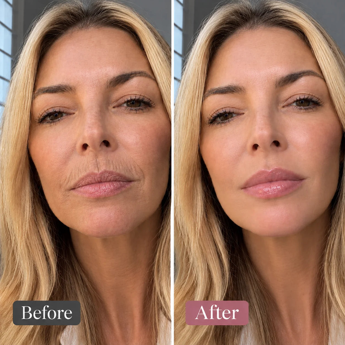 Frustrated By Vertical Lines? Here's Why 50,000+ Women Switched To THIS