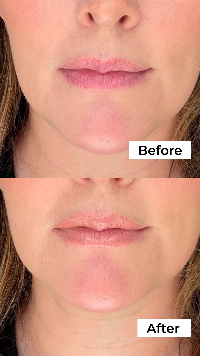 Before and after result