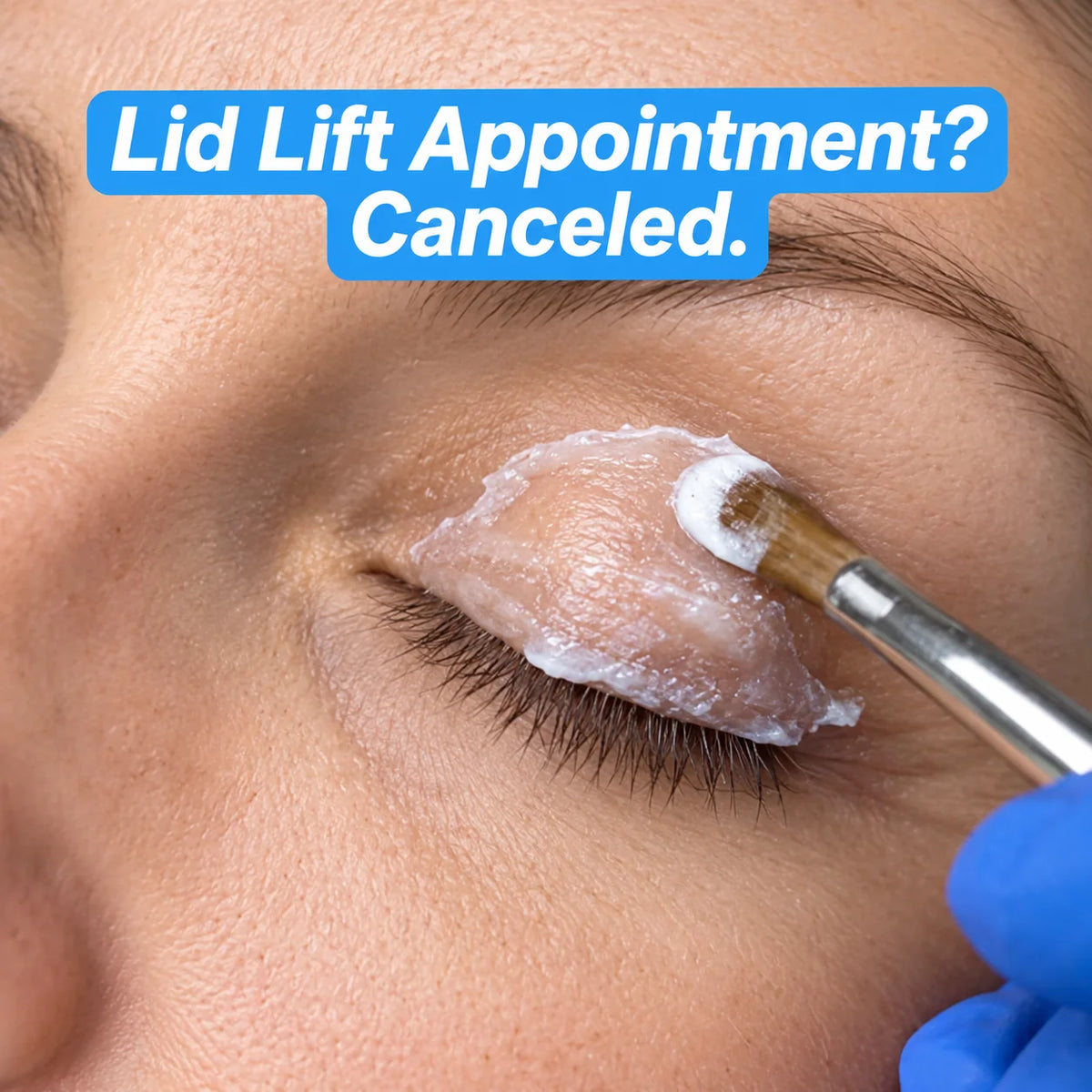 <i>Considering An Upper Bleph or Lid Lift? Here's Why 50,000+ Women Canceled Their Appointments</i>