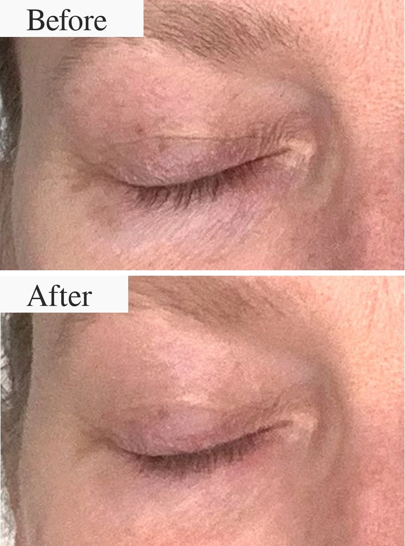 Before and after result