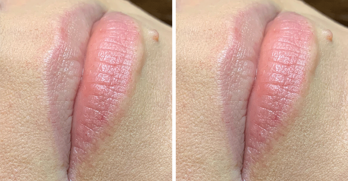 The "Needle-Free" Plump in 60 Seconds