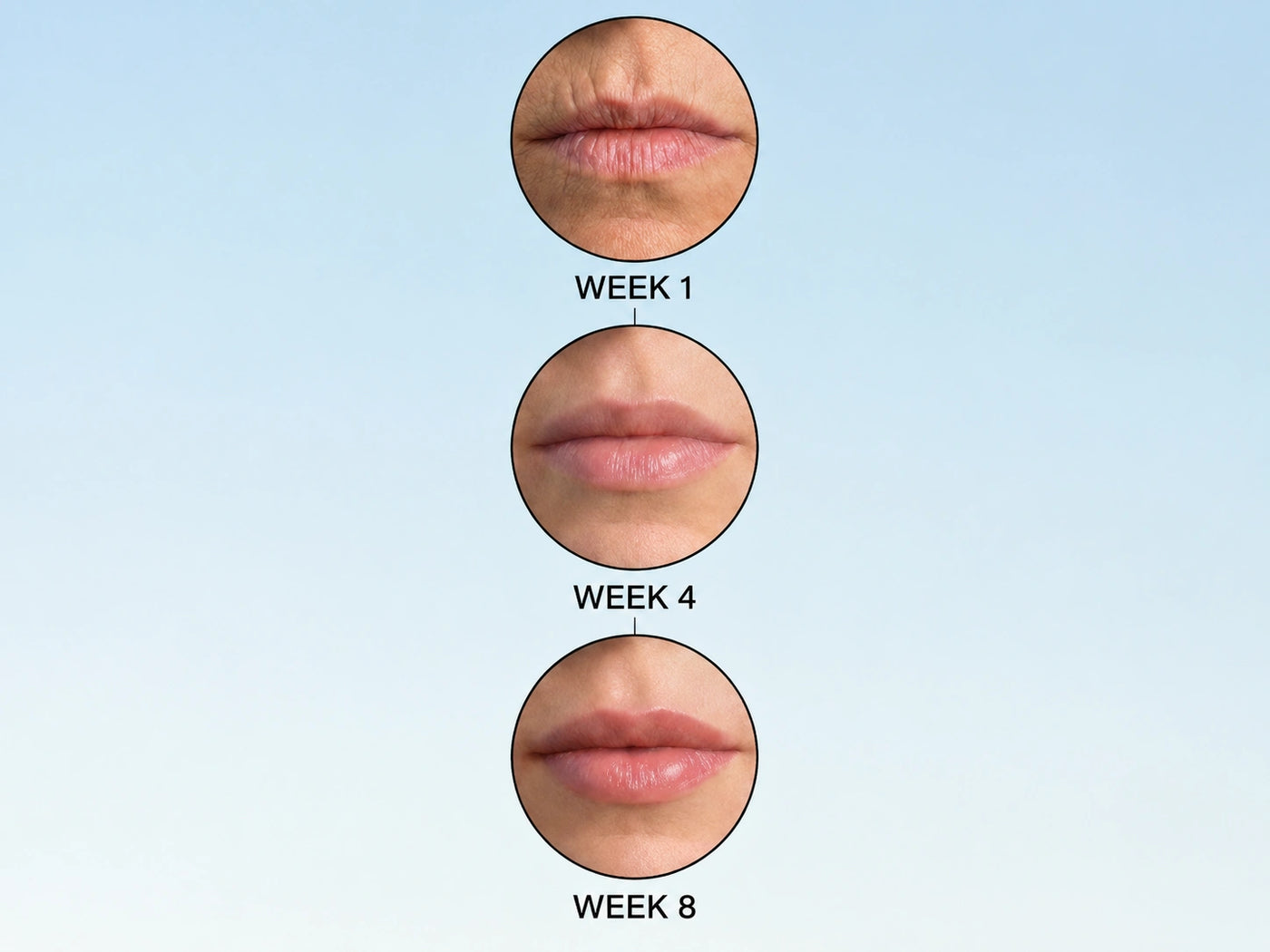 <i>Lost Your Natural Lip Contour? Here's Why 50,000+ Women Switched To THIS</i>