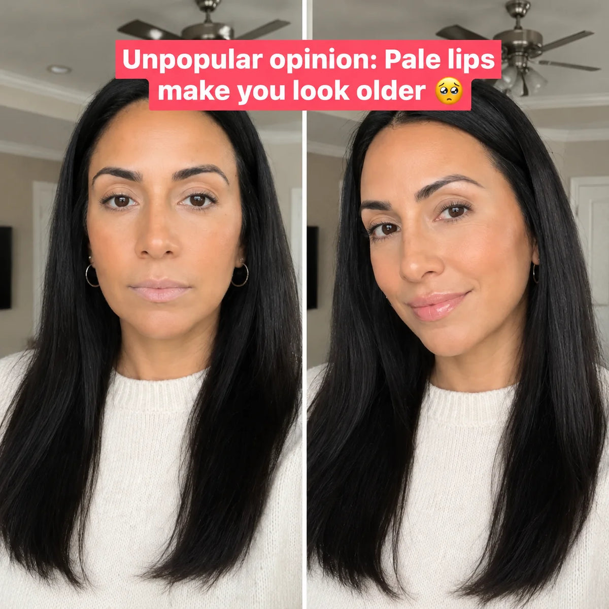 Thinking About Lip Fillers? Here's Why 50,000+ Women Canceled Their Appointments