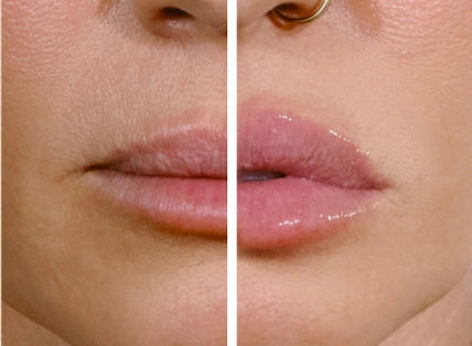 The "Needle-Free" Plump in 60 Seconds