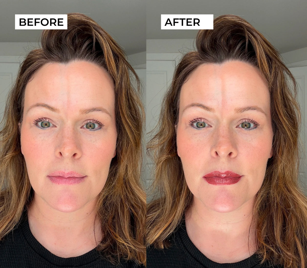 Thinking About Lip Fillers? Here's Why 50,000+ Women Canceled Their Appointments