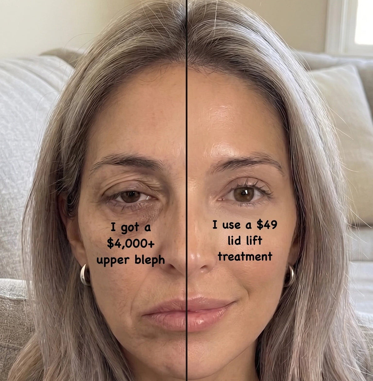 <i>Considering An Upper Bleph or Lid Lift? Here's Why 50,000+ Women Canceled Their Appointments</i>