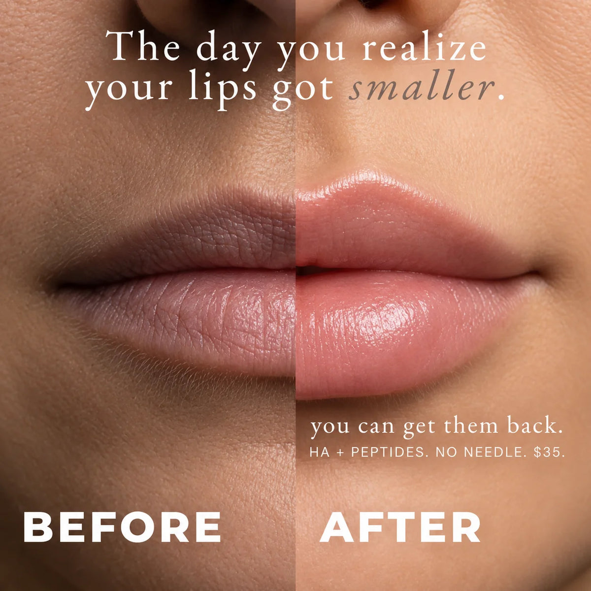 Realizing Your Lips Are Getting Smaller? Here's How 50,000+ Women Got Them Back By Switching To THIS