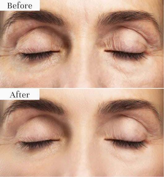 4. Instant Results