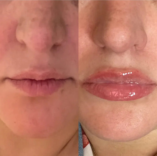 Real Customer Results: