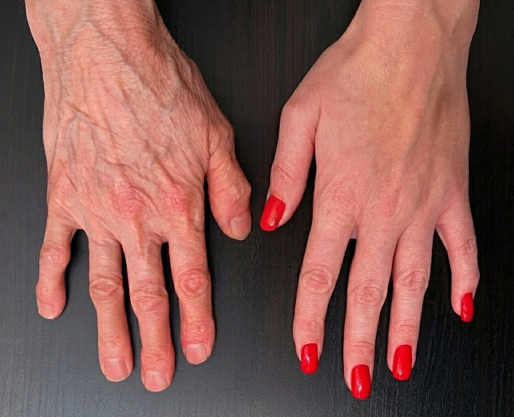 Restoring Hand Treatment