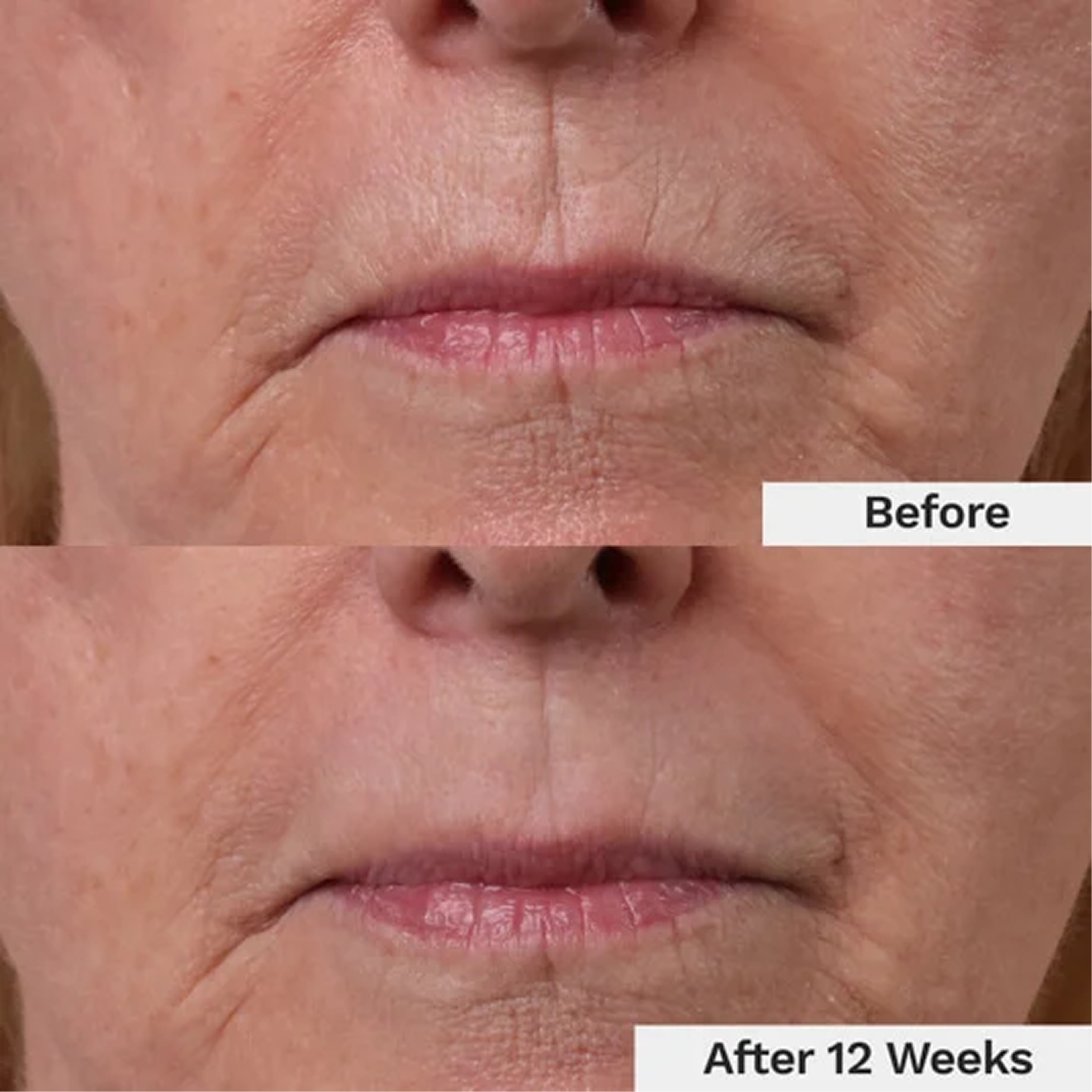 See Visible Results