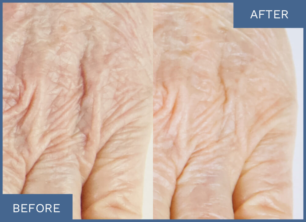 <strong>See Visible Results</strong>